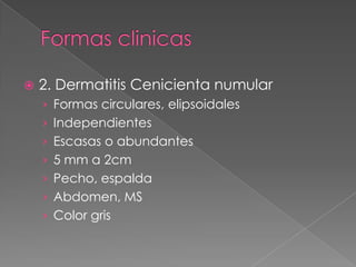 

2. Dermatitis Cenicienta numular
› Formas circulares, elipsoidales
› Independientes

› Escasas o abundantes
› 5 mm a 2cm
› Pecho, espalda
› Abdomen, MS
› Color gris

 
