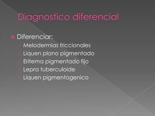

Diferenciar:
› Melodermias friccionales
› Liquen plano pigmentado

› Eritema pigmentado fijo
› Lepra tuberculoide
› Liquen pigmentogenico

 
