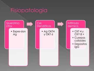 Queratinocitos

• Expre-sion
Ag

Cel.
Dendriticas

• Ag OKT4
y OKT 6

Infiltrado
dermico

• CKT 4 y
CKY 8 +
• Cuerpos
colioides
• Depositos
IgG

 
