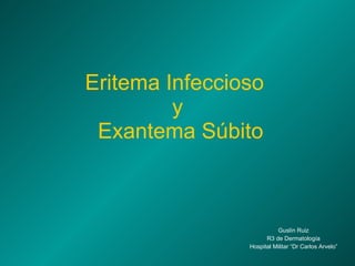 Eritema Infeccioso  y  Exantema Súbito Guslín Ruiz R3 de Dermatología Hospital Militar “Dr Carlos Arvelo” 