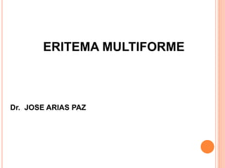 ERITEMA MULTIFORME
Dr. JOSE ARIAS PAZ
 