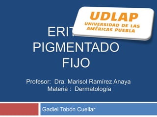 ERITEMA 
PIGMENTADO 
FIJO 
Profesor: Dra. Marisol Ramírez Anaya 
Materia : Dermatología 
Gadiel Tobón Cuellar 
 