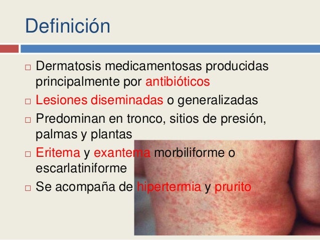 Natas de pigmentação em uma cara