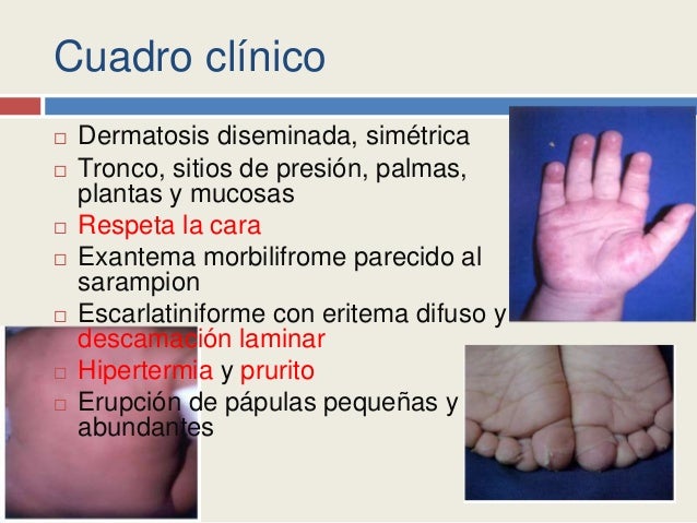 Eritema pigmentado fijo y eritema morbiliforme