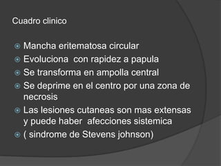 Cuadro clinico

 Mancha eritematosa circular
 Evoluciona con rapidez a papula
 Se transforma en ampolla central
 Se deprime en el centro por una zona de
  necrosis
 Las lesiones cutaneas son mas extensas
  y puede haber afecciones sistemica
 ( sindrome de Stevens johnson)
 