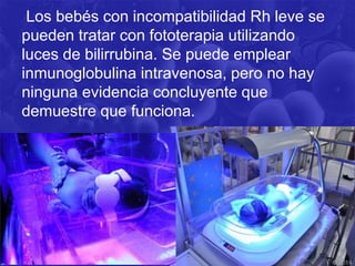 Los bebés con incompatibilidad Rh leve se
pueden tratar con fototerapia utilizando
luces de bilirrubina. Se puede emplear
inmunoglobulina intravenosa, pero no hay
ninguna evidencia concluyente que
demuestre que funciona.
 