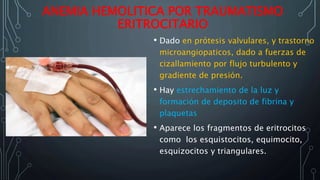 ANEMIA HEMOLITICA POR TRAUMATISMO
ERITROCITARIO
• Dado en prótesis valvulares, y trastorno
microangiopaticos, dado a fuerzas de
cizallamiento por flujo turbulento y
gradiente de presión.
• Hay estrechamiento de la luz y
formación de deposito de fibrina y
plaquetas
• Aparece los fragmentos de eritrocitos
como los esquistocitos, equimocito,
esquizocitos y triangulares.
 