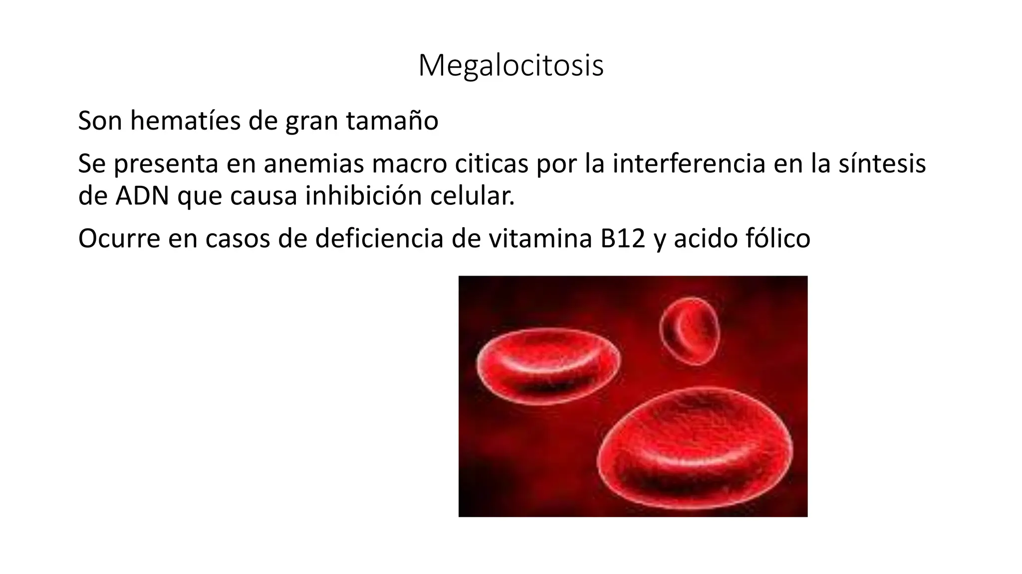 Megalocitosis
Son hematíes de gran tamaño
Se presenta en anemias macro citicas por la interferencia en la síntesis
de ADN que causa inhibición celular.
Ocurre en casos de deficiencia de vitamina B12 y acido fólico
 