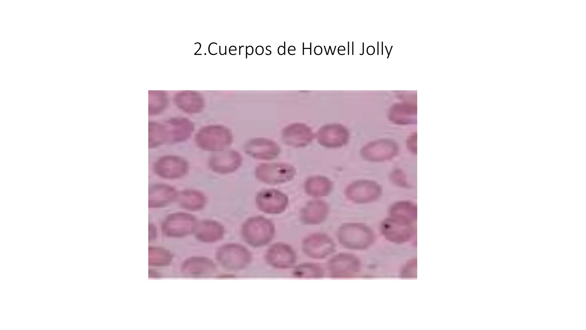 2.Cuerpos de Howell Jolly
 
