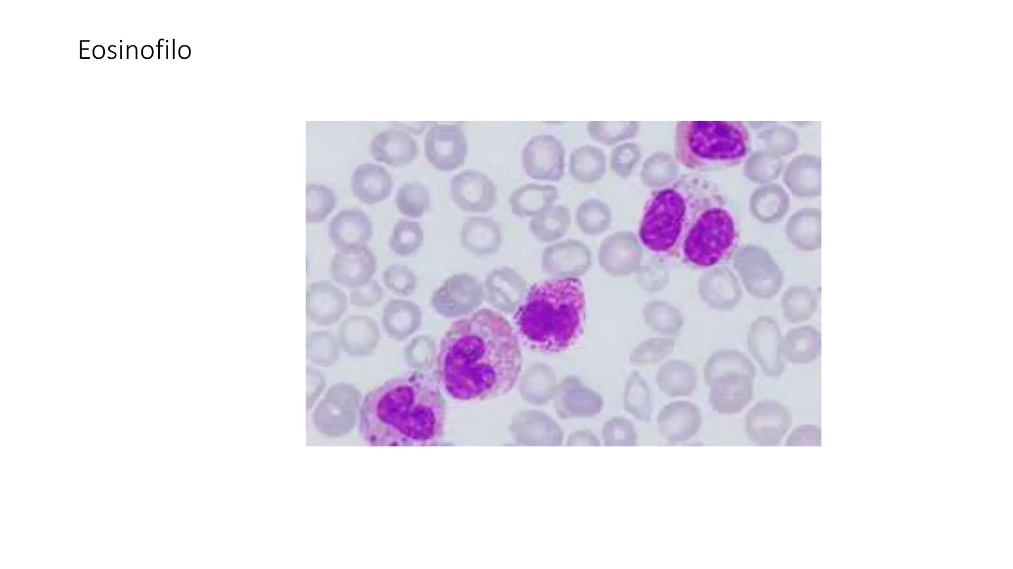 Eosinofilo
 