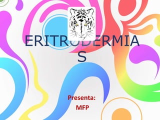 ERITRODERMIA
S
Presenta:
MFP
 