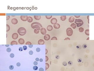 Regeneração
 