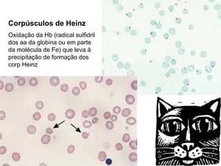 Corpúsculos de Heinz
Oxidação da Hb (radical sulfidril
dos aa da globina ou em parte
da molécula de Fe) que leva à
precipitação de formação dos
corp Heinz
 