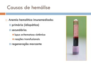 Causas de hemólise

   Anemia hemolítica imunemediada:
     primária    (idiopática)
     secundária:
       lupus   eritematoso sistêmico
       reações   transfusionais
     regeneração      marcante
 
