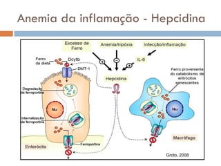 Anemia da inflamação - Hepcidina




                         Groto, 2008
 