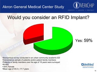 Akron General Medical Center Study Would you consider an RFID Implant? Anonymous survey conducted in an urban community academic ED Convenience sample of patients and/or patient family members Patients or family members over the age of 18 years were surveyed N=402 -55% Female Mean age of 45.0  +  17.7 years Yes:  59% 
