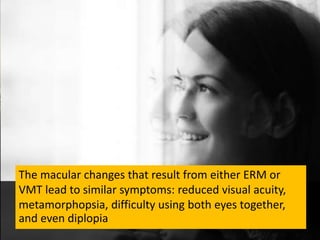 Epiretinal membrane and vitreomacula traction in updates by Panit ...