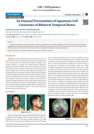 1/3
Introduction
Malignancies of the temporal bone are rare with an incidence of
less than 0.2% amongst all head neck cancers [1]. Amongst them,
most are squamous cell carcinoma of the external auditory canal.
Despite advances in surgical and radiotherapeutic techniques,
prognosis for patients with this disease has remained poor [2,3].
The median age at presentation of squamous cell carcinoma (SCC)
of the temporal bone is in the seventh decade. Occasionally, SCC of
the temporal bone can develop in younger adults and the possibility
should not be ignored merely on the basis of age [4]. We report a
case of SCC of both temporal bones in a 30 year old male patient,
who presented very late with extensive disease in one ear, and so
could be managed by palliative therapy only. Bilateral presentation
of SCC in the external ear canal is an exceedingly rare presentation
and a handful of them have been reported till date in literature. To
the best of our knowledge, this is the 11th
case of SCC of bilateral
temporal bones in literature [5,6].
Case Report
Figure 1a & 1b
30yearsoldmalepatientpresentedtoENTOPDwithcomplaints
of bilateral foul smelling, painful, occasionally blood mixed ear
discharge for the past three years, painful swelling on the right
side of the face for the past six months, and deviation of the angle
of the mouth on the right side for the past two weeks. There was
a history of the patient undergoing some ear surgery about three
years prior, but no documents pertaining to the surgery were found.
He was a farmer by profession, and there was no prior history of
any exposure to radiation. On examination, there was a large
swelling on the right side of the face, about 8cm x 5cm in size, which
was hard, tender, fixed to the lower structures and skin, with the
overlying skin inflamed, and ulcerated at places. The ear lobule was
displaced laterally by the swelling which involved the right parotid.
There was also right sided Lower Motor Neurone type facial palsy,
with incomplete closure of the eyes on maximum effort (Figure 1a
& 1b). Mouth opening was restricted to one and a half fingers. He
had no other neurodeficit. On otoscopy and otoendoscopy, both
ear canals were occluded by reddish proliferative tissue that was
extremely vascular and bled on touch. A dirty white discharge was
also found to be smeared around the reddish masses (Figure 2). He
complained of decreased hearing in both the ears, but pure tone
audiometry was impossible as mere placement of the headphones
over the mastoid resulted in severe pain. Rest of the systemic
examination did not reveal any abnormality.
Figure 2
Asok Kumar Saha, Titas Kar* and Nirmalya Roy
Department of ENT & Head Neck surgery, Medical College Kolkata, India
*Corresponding author: Titas Kar, Department of ENT & Head Neck surgery, Medical College Kolkata, India, Email:
Submission: January 17, 2018; Published: January 22, 2018
An Unusual Presentation of Squamous Cell
Carcinoma of Bilateral Temporal Bones
Exp Rhinol Otolaryngol
Copyright © All rights are reserved by Titas Kar.
CRIMSONpublishers
http://www.crimsonpublishers.com
Abstract
Squamous cell carcinoma of temporal bone is a rare entity, comprising of a very small percentage of all head neck tumours, mostly occurring in
aged population. Bilateral presentation of tumours in both temporal bones is extremely rare and only a few cases have been reported. We report a case
of bilateral squamous cell carcinoma of both temporal bones in a young adult male patient who presented very late.
Keywords: Squamous cell carcinoma; Bilateral; Temporal bone; External auditory canal
Case Report	
ISSN 2637-7780
 