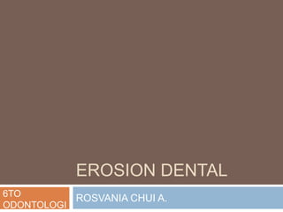 EROSION DENTAL 
ROSVANIA CHUI A. 6TO 
ODONTOLOGI 
 
