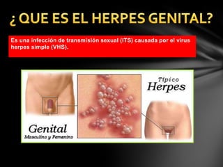 Es una infección de transmisión sexual (ITS) causada por el virus
herpes simple (VHS).
 