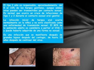 El tipo I sólo es responsable, aproximadamente, del
5 al 10% de los herpes genitales, aunque ambos
virus pueden ser transmitidos por contacto sexual.
Es normal que ocurra un cruce de infecciones de
tipo 1 y 2 durante el contacto sexual oral-genital.
La infección inicial de herpes oral ocurre
normalmente en la niñez y no está clasificada como
una enfermedad de transmisión sexual. El 80% de
la población adulta es candidata a portar el VHS-1
y puede haberlo adquirido de una forma no sexual.
Es una infección que se manifiesta después de
grandes lapsos después del contagio, de hasta 15
años después de contraer del virus.
 