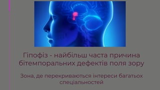 Гіпофіз - найбільш часта причина
бітемпоральних дефектів поля зору
Зона, де перекриваються інтереси багатьох
спеціальностей
 