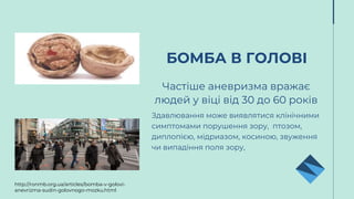 Частіше аневризма вражає
людей у віці від 30 до 60 років
Здавлювання може виявлятися клінічними
симптомами порушення зору, птозом,
диплопією, мідриазом, косиною, звуження
чи випадіння поля зору,
БОМБА В ГОЛОВІ
http://ronmb.org.ua/articles/bomba-v-golovi-
anevrizma-sudin-golovnogo-mozku.html
 