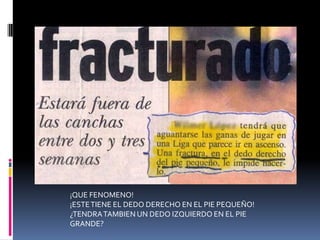 ¡QUE FENOMENO!¡ESTE TIENE EL DEDO DERECHO EN EL PIE PEQUEÑO!¿TENDRA TAMBIEN UN DEDO IZQUIERDO EN EL PIE GRANDE?