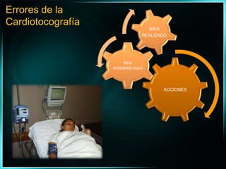 Errores de laCardiotocografía