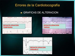 GRAFICAS DE ALTERACIONErrores de la CardiotocografíaDESACELERACION TEMPRANADESACELERACION TARDIADESACELERACION VARIABLE