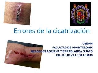 Errores de la cicatrización
UMSNH
FACULTAD DE ODONTOLOGIA
MERCEDES ADRIANA TIERRABLANCA GUAPO
DR. JULIO VILLEDA LEMUS
 