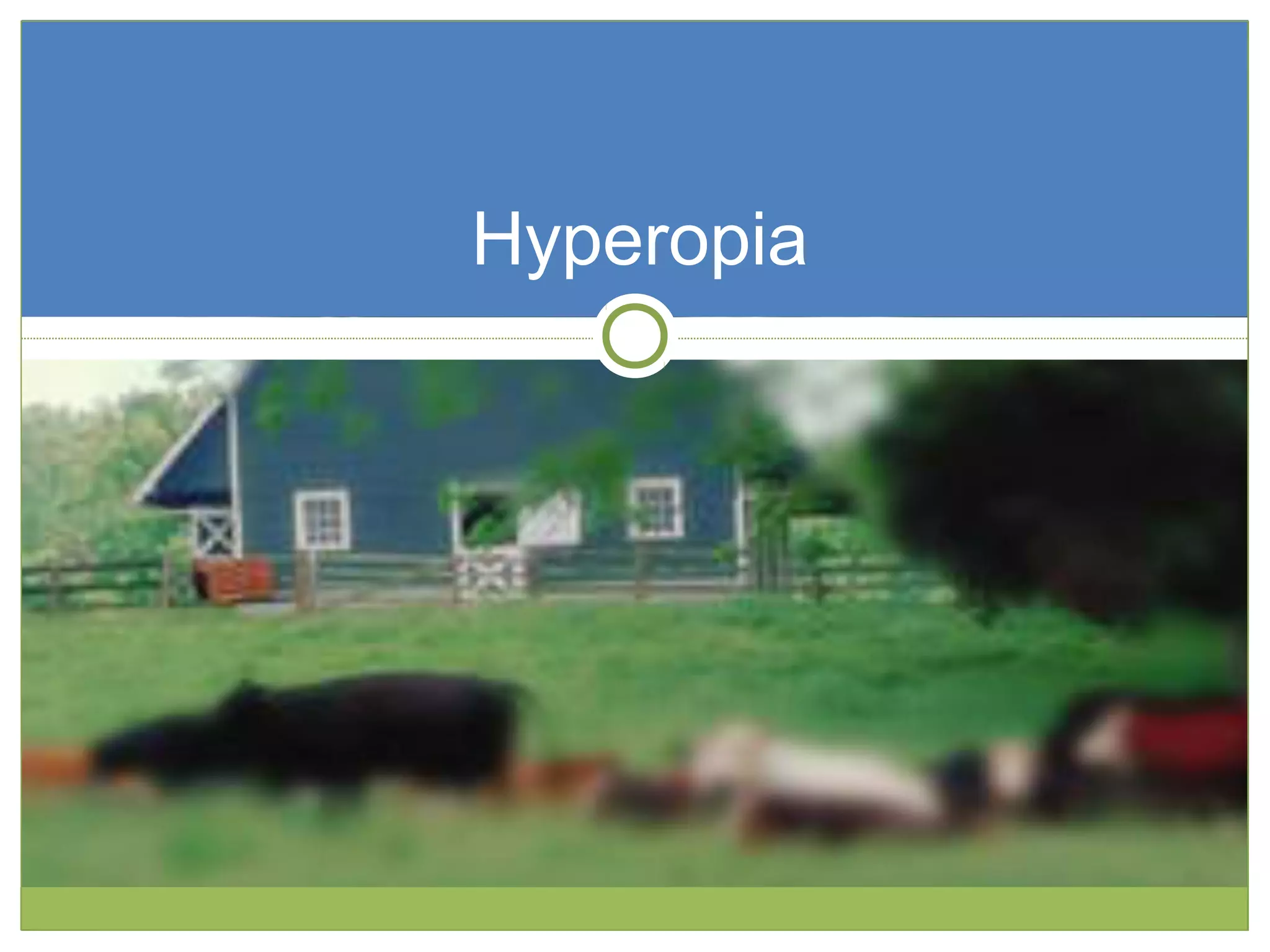 Hyperopia
 