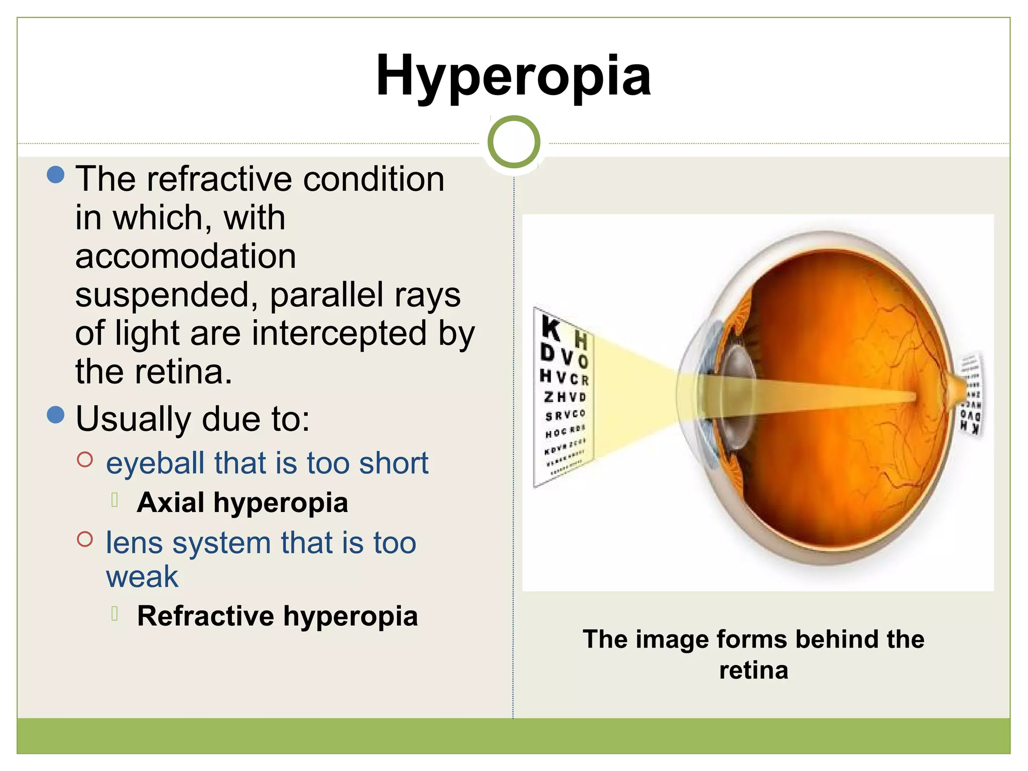 Hyperopia
The refractive condition
in which, with
accomodation
suspended, parallel rays
of light are intercepted by
the retina.
Usually due to:
 eyeball that is too short
 Axial hyperopia
 lens system that is too
weak
 Refractive hyperopia
The image forms behind the
retina
 