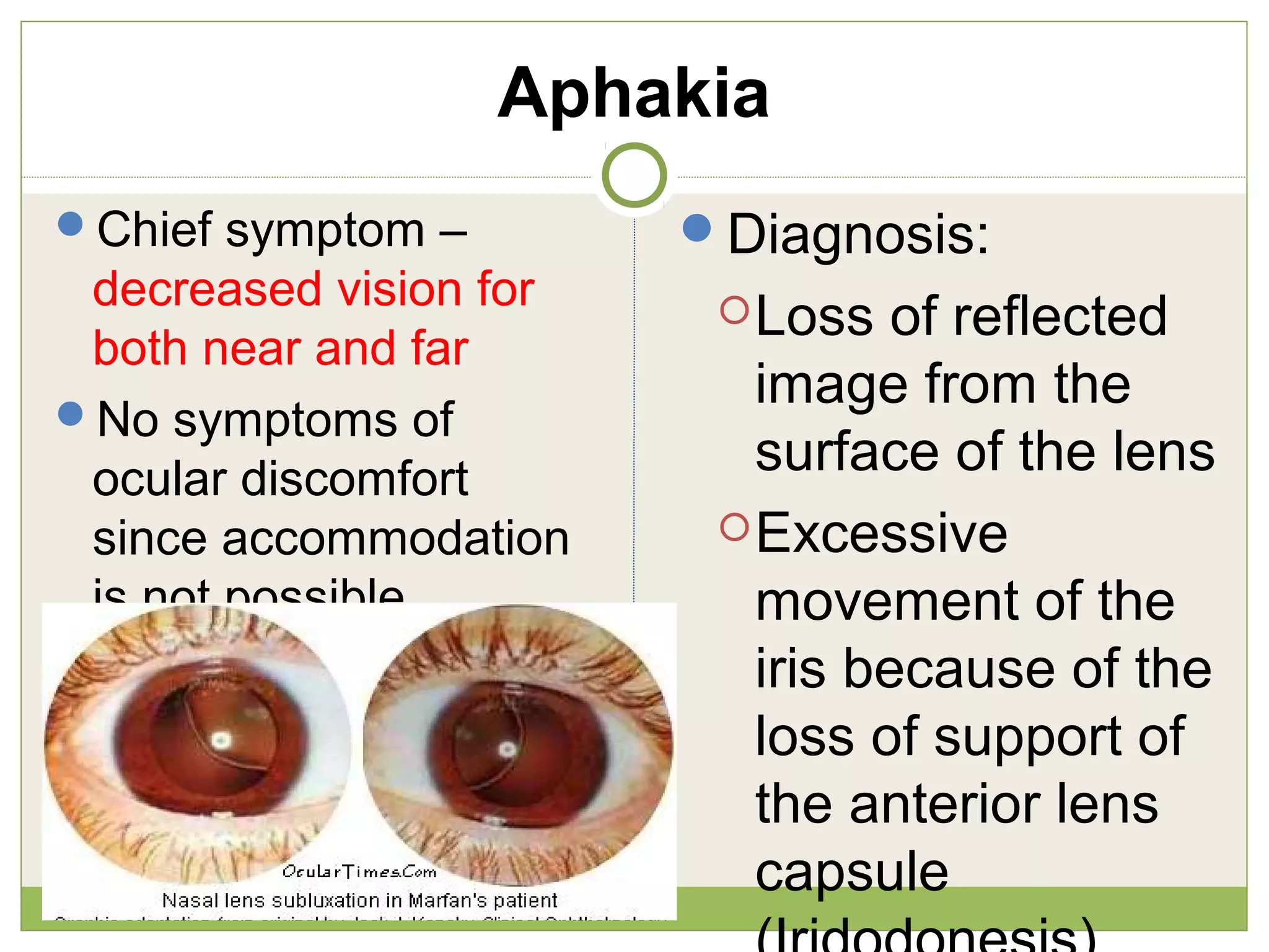 Aphakia
Chief symptom –
decreased vision for
both near and far
No symptoms of
ocular discomfort
since accommodation
is not possible.
Diagnosis:
Loss of reflected
image from the
surface of the lens
Excessive
movement of the
iris because of the
loss of support of
the anterior lens
capsule
 
