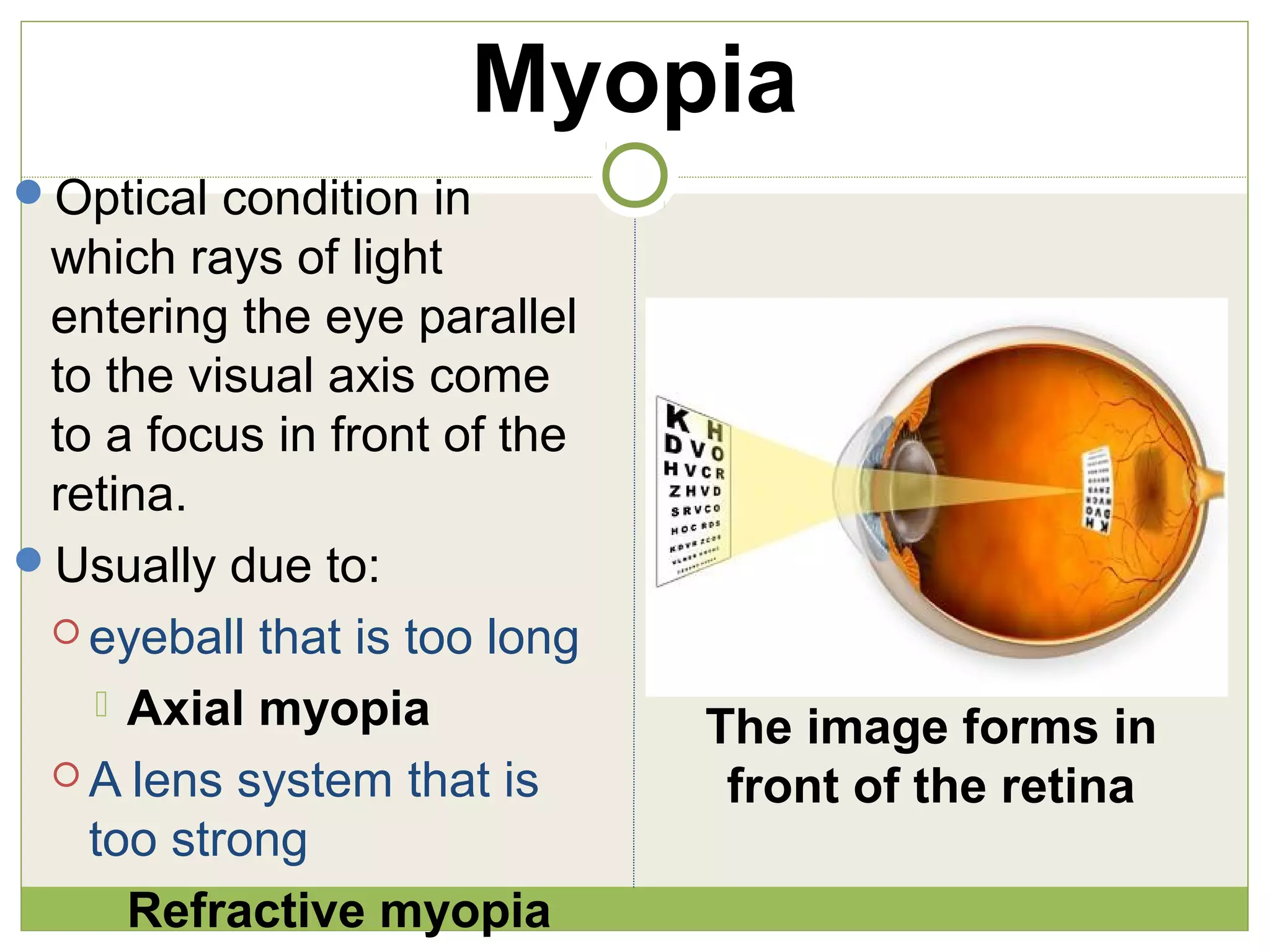 Myopia
Optical condition in
which rays of light
entering the eye parallel
to the visual axis come
to a focus in front of the
retina.
Usually due to:
 eyeball that is too long
 Axial myopia
 A lens system that is
too strong
 Refractive myopia
The image forms in
front of the retina
 