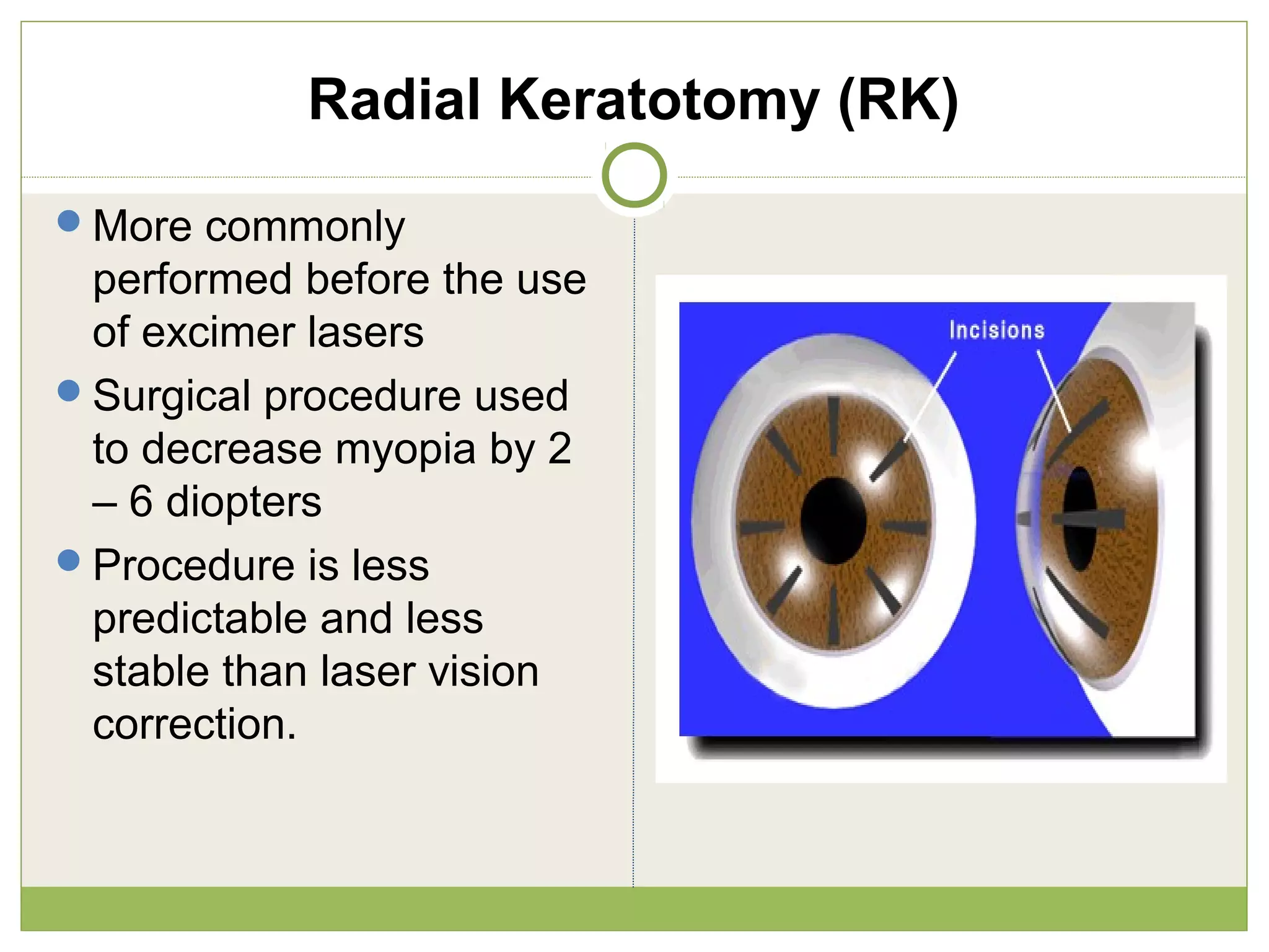 Radial Keratotomy (RK)
More commonly
performed before the use
of excimer lasers
Surgical procedure used
to decrease myopia by 2
– 6 diopters
Procedure is less
predictable and less
stable than laser vision
correction.
 