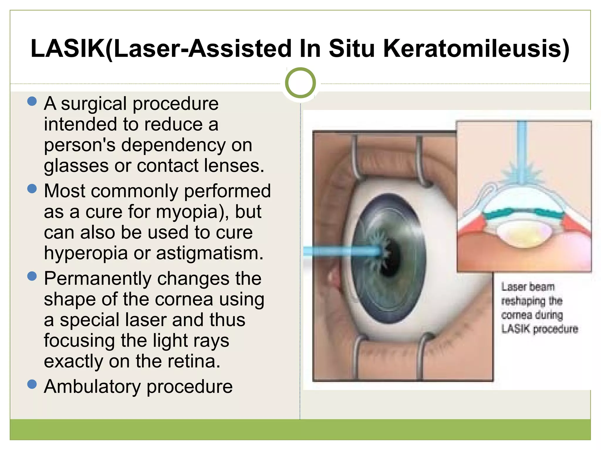 LASIK(Laser-Assisted In Situ Keratomileusis)
A surgical procedure
intended to reduce a
person's dependency on
glasses or contact lenses.
Most commonly performed
as a cure for myopia), but
can also be used to cure
hyperopia or astigmatism.
Permanently changes the
shape of the cornea using
a special laser and thus
focusing the light rays
exactly on the retina.
Ambulatory procedure
 