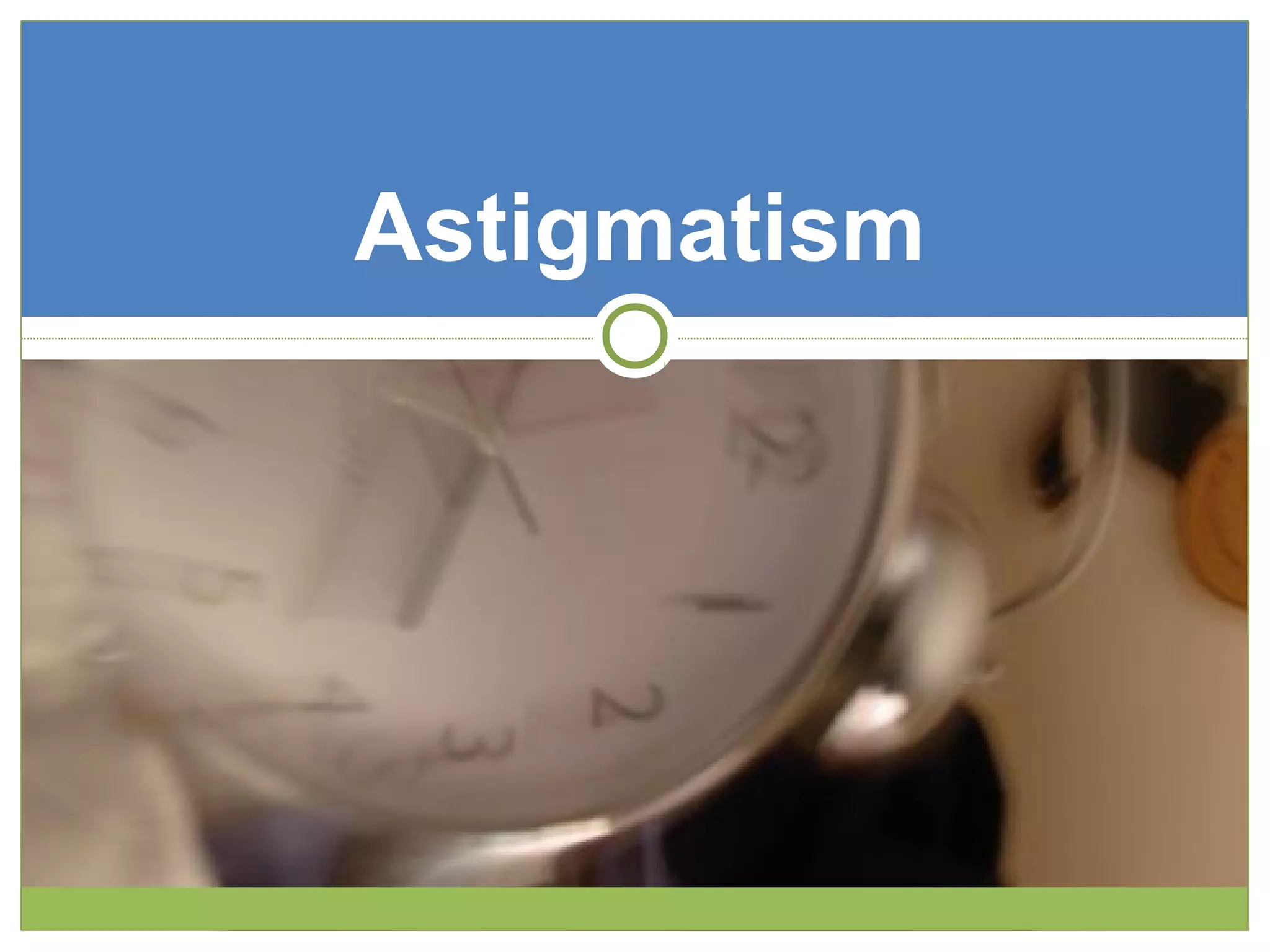 Astigmatism
 