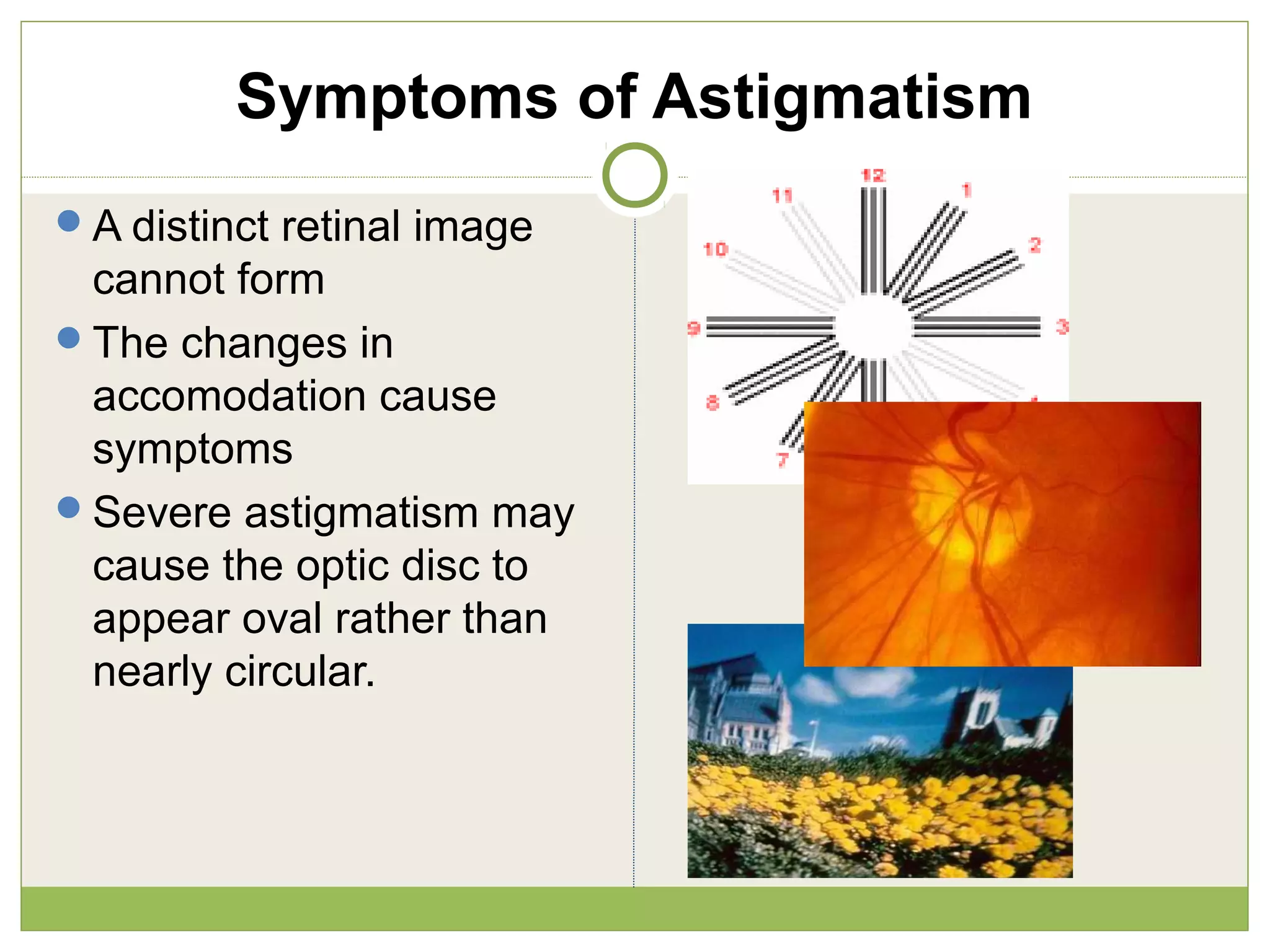 Symptoms of Astigmatism
A distinct retinal image
cannot form
The changes in
accomodation cause
symptoms
Severe astigmatism may
cause the optic disc to
appear oval rather than
nearly circular.
 