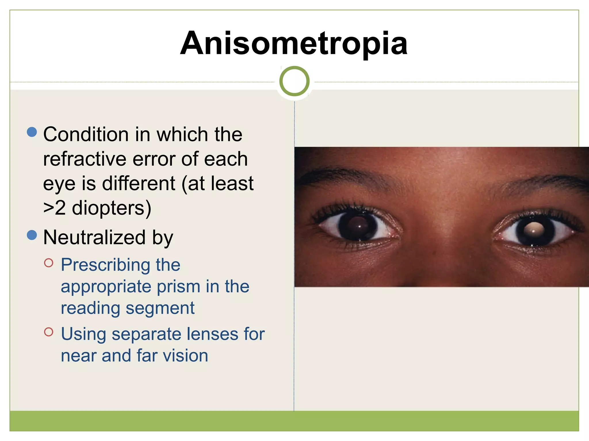 Anisometropia
Condition in which the
refractive error of each
eye is different (at least
>2 diopters)
Neutralized by
 Prescribing the
appropriate prism in the
reading segment
 Using separate lenses for
near and far vision
 