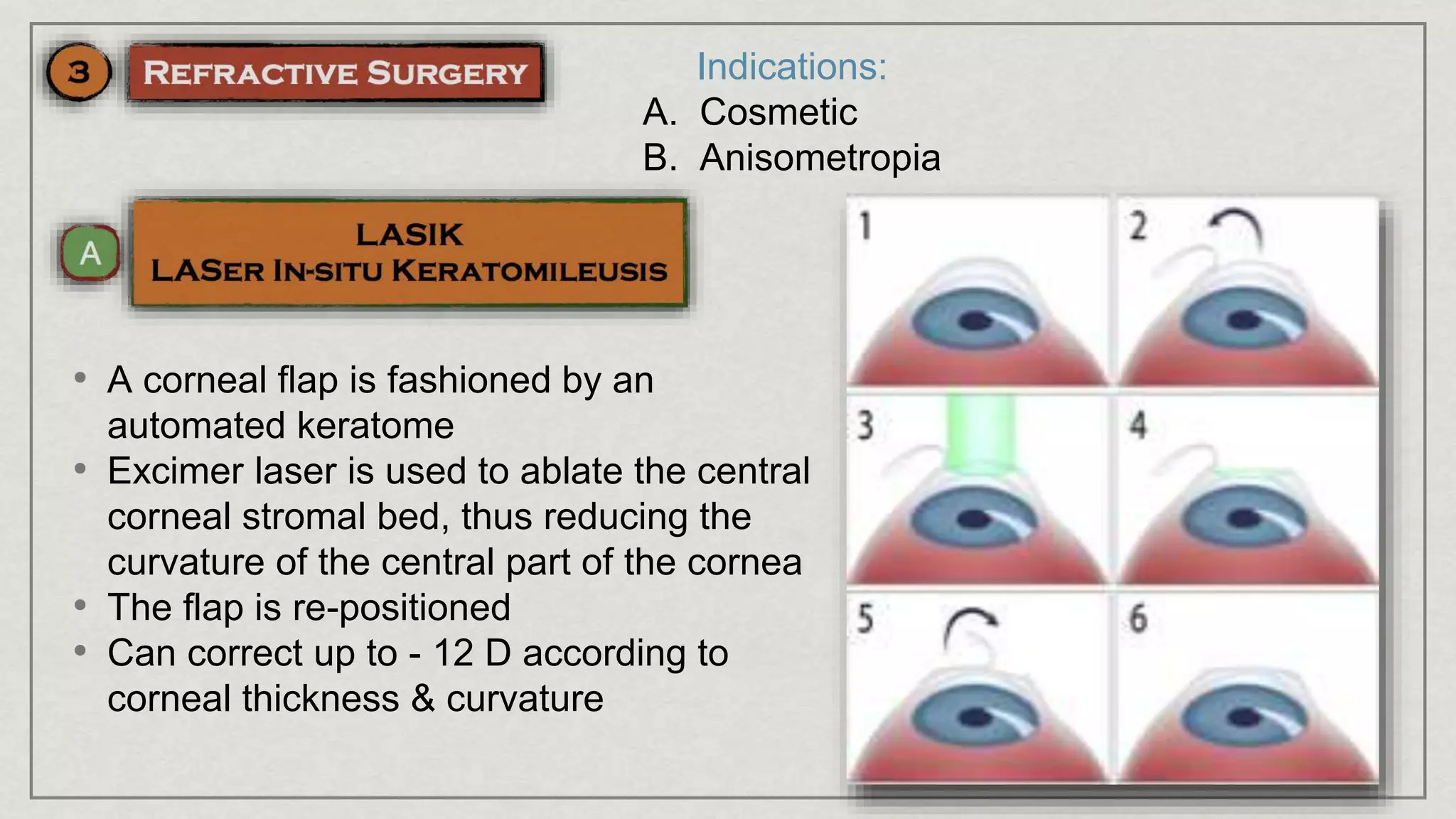 Indications:
A. Cosmetic
B. Anisometropia
• A corneal flap is fashioned by an
automated keratome
• Excimer laser is used to ablate the central
corneal stromal bed, thus reducing the
curvature of the central part of the cornea
• The flap is re-positioned
• Can correct up to - 12 D according to
corneal thickness & curvature
 