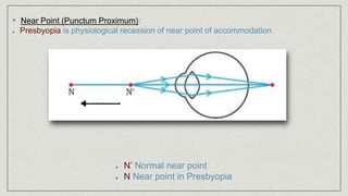 • Near Point (Punctum Proximum):
Presbyopia is physiological recession of near point of accommodation
N’ Normal near point
N Near point in Presbyopia
 