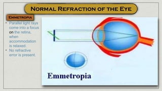 • Parallel light rays
come into a focus
on the retina,
when
accommodation
is relaxed.
• No refractive
error is present.
 