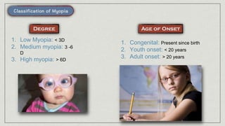 1. Low Myopia: < 3D
2. Medium myopia: 3 -6
D
3. High myopia: > 6D
1. Congenital: Present since birth
2. Youth onset: < 20 years
3. Adult onset: > 20 years
 