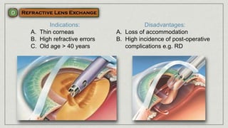 Indications:
A. Thin corneas
B. High refractive errors
C. Old age > 40 years
Disadvantages:
A. Loss of accommodation
B. High incidence of post-operative
complications e.g. RD
 