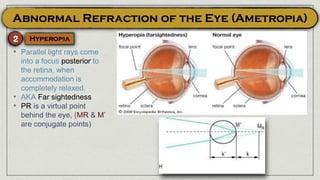 • Parallel light rays come
into a focus posterior to
the retina, when
accommodation is
completely relaxed.
• AKA Far sightedness
• PR is a virtual point
behind the eye, (MR & M’
are conjugate points)
 