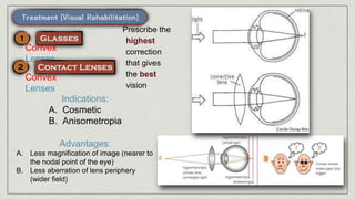 Convex
Lenses
Convex
Lenses
Indications:
A. Cosmetic
B. Anisometropia
Advantages:
A. Less magnification of image (nearer to
the nodal point of the eye)
B. Less aberration of lens periphery
(wider field)
Prescribe the
highest
correction
that gives
the best
vision
 