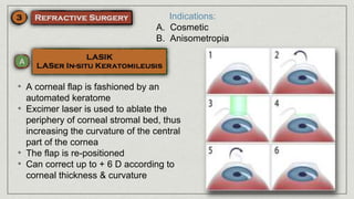 Indications:
A. Cosmetic
B. Anisometropia
• A corneal flap is fashioned by an
automated keratome
• Excimer laser is used to ablate the
periphery of corneal stromal bed, thus
increasing the curvature of the central
part of the cornea
• The flap is re-positioned
• Can correct up to + 6 D according to
corneal thickness & curvature
 