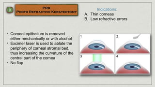 Indications:
A. Thin corneas
B. Low refractive errors
• Corneal epithelium is removed
either mechanically or with alcohol
• Excimer laser is used to ablate the
periphery of corneal stromal bed,
thus increasing the curvature of the
central part of the cornea
• No flap
 