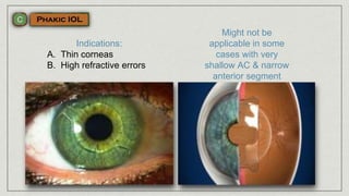 Indications:
A. Thin corneas
B. High refractive errors
Might not be
applicable in some
cases with very
shallow AC & narrow
anterior segment
 